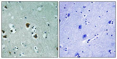 CRMP-2 (Ab-509) Antibody