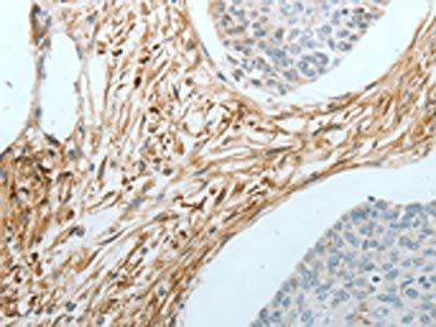 CRMP1 Antibody
