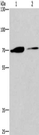 CROT antibody