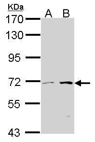 CROT antibody [N2C2], Internal