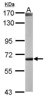 CROT antibody [N2C2], Internal