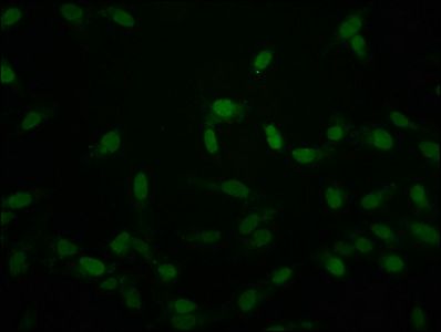 Crotonyl-HIST1H2AG (K118) antibody