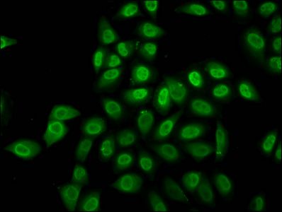 Crotonyl-HIST1H2BC (K12) Antibody