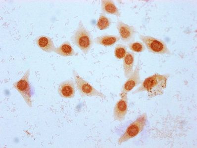 Crotonyl-HIST1H2BC (K16) Antibody