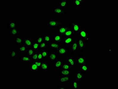 Crotonyl-HIST1H2BC (K16) Antibody
