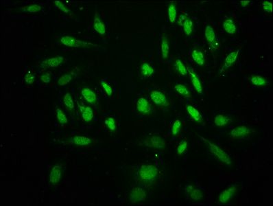 Crotonyl-HIST1H3A (K18) antibody