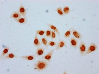 Crotonyl-HIST1H3A (K9) Antibody
