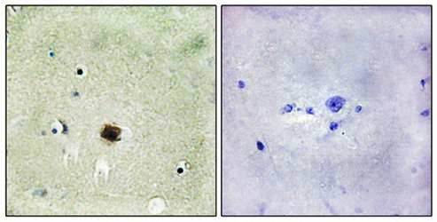 CRP1 Antibody