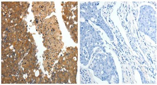 CRP Antibody