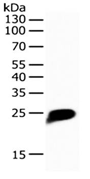 CRP Antibody