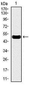 CRP Antibody