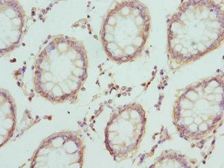 CRTAP Antibody