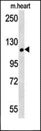 CRUM2 antibody