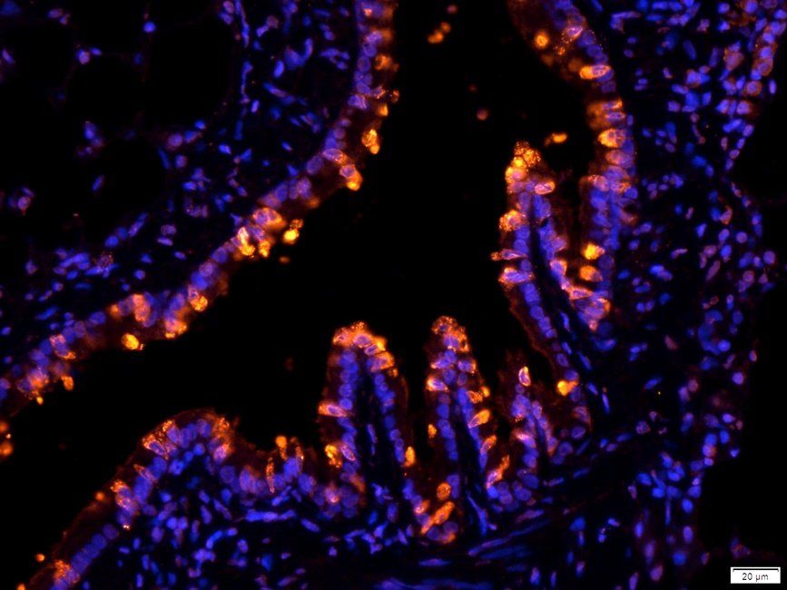 CRUM3 antibody