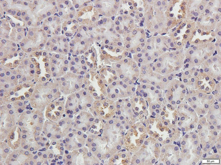 CRUM3 antibody