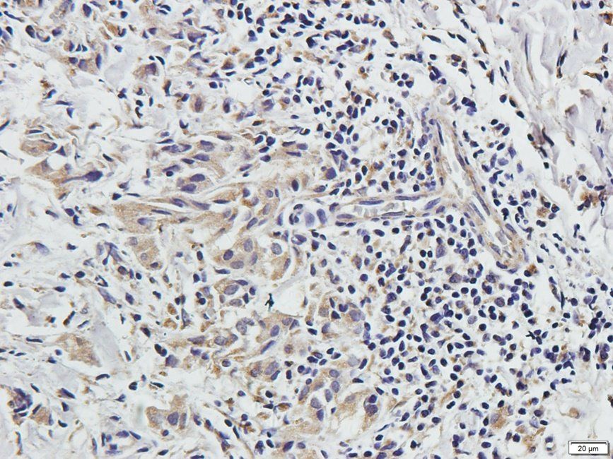 CRUM3 antibody