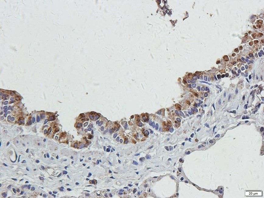 CRUM3 antibody