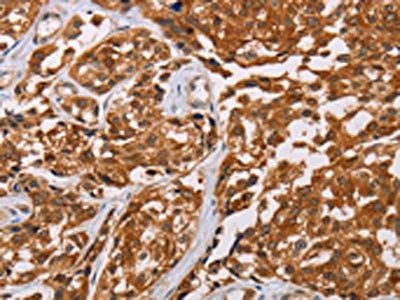 CRYAB Antibody