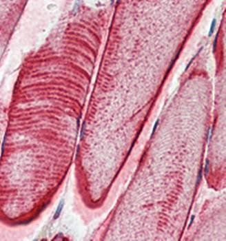 CRYAB Antibody