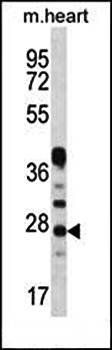 CRYBA1 antibody