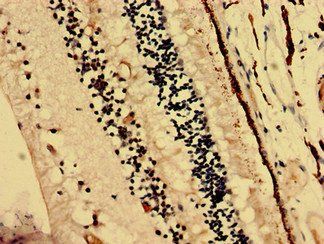 CRYBA4 Antibody