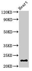 CRYBA4 Antibody