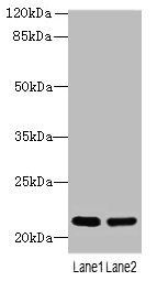 CRYBA4 Antibody
