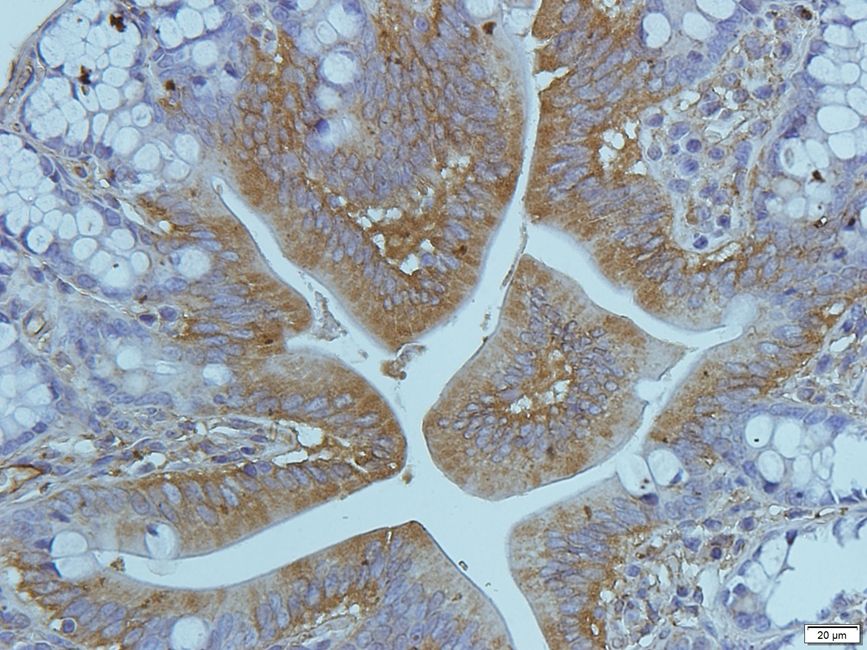 Cryopyrin antibody