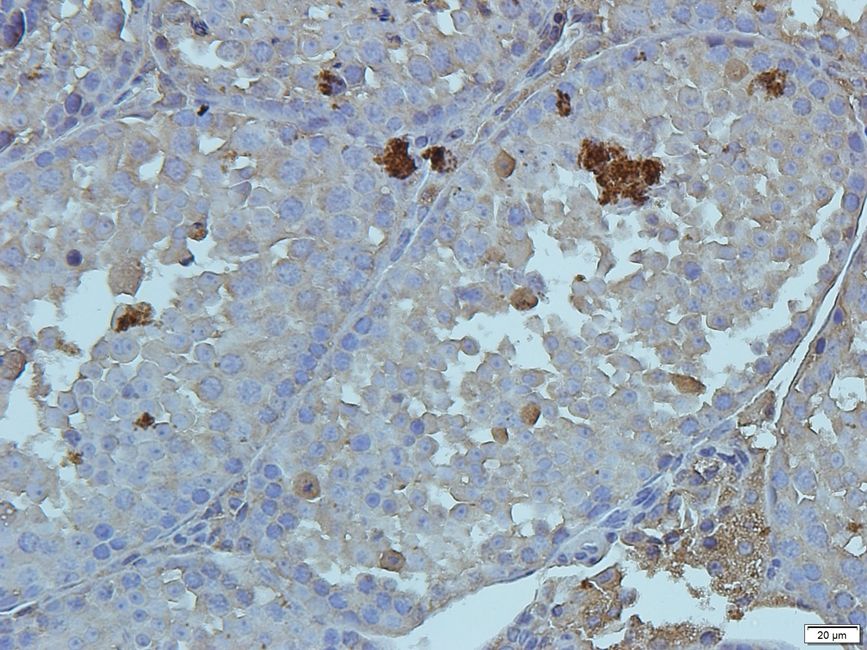 Cryopyrin antibody