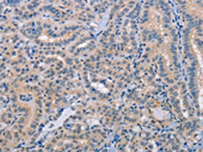 NLRP3 Antibody
