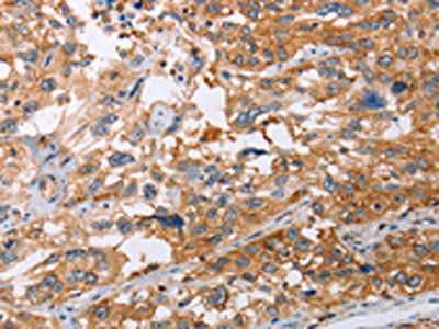 NLRP3 Antibody