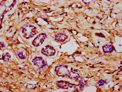 CSAD Antibody