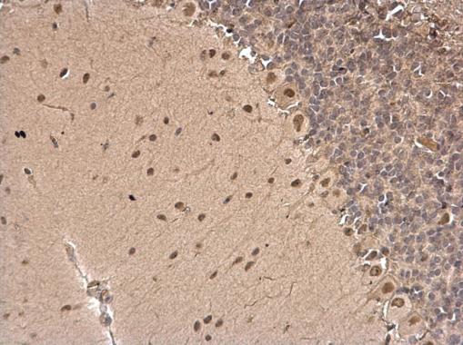 CSB antibody [N2C1], Internal