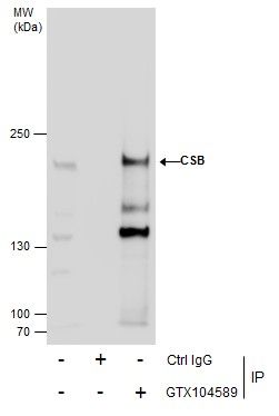CSB antibody