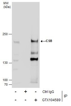 CSB antibody [N2C1], Internal