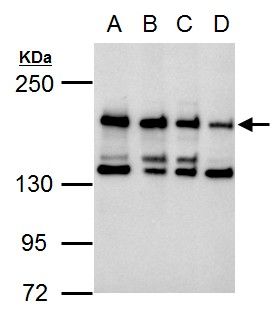 CSB antibody