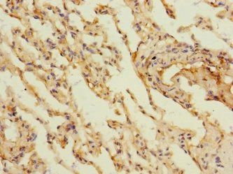 MARCO Antibody
