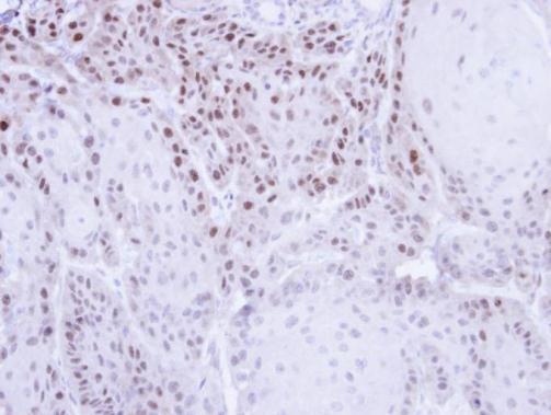 chromosome segregation 1 like Antibody