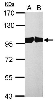 chromosome segregation 1 like Antibody