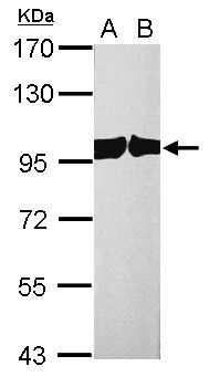 CSE1L antibody