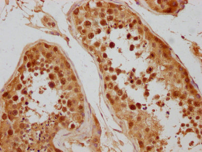 CSE1L antibody