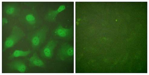 CSE1L antibody