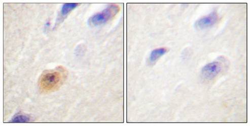 CSE1L Antibody