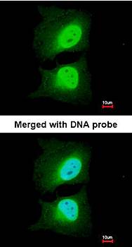 CSE1L antibody
