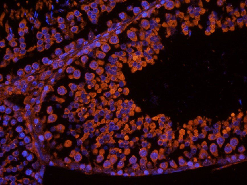 CSEN antibody