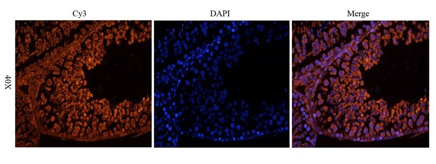 CSEN antibody