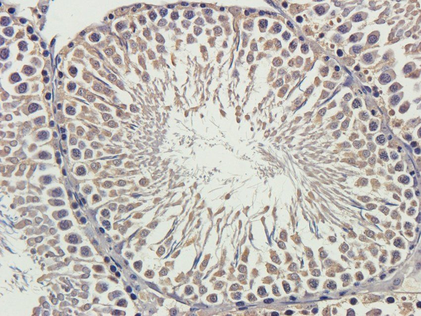 CSEN antibody