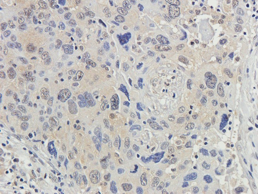 CSEN antibody