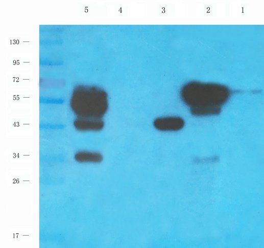 CSEN antibody