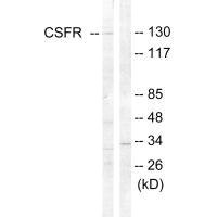 CSF1R (Ab-809) antibody